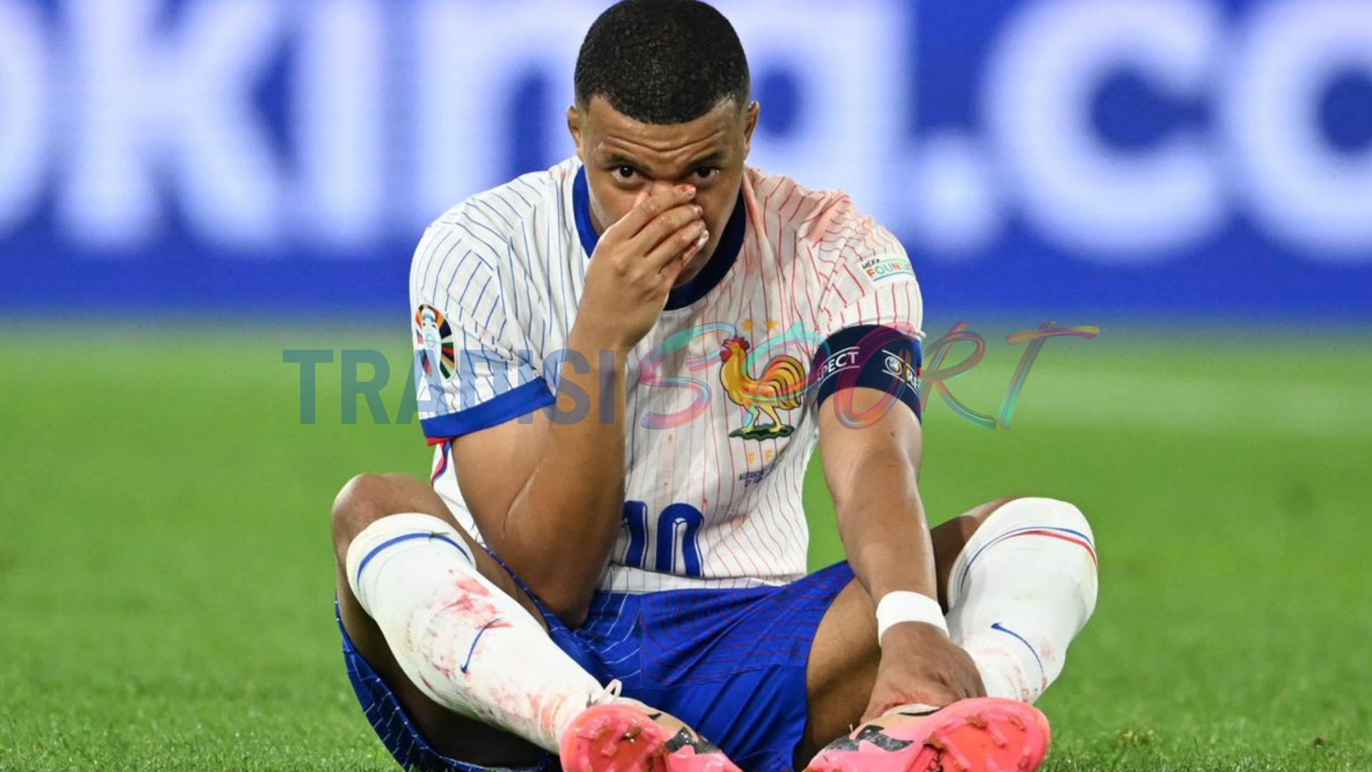 Cedera Hidung Ganggu Performa Mbappe